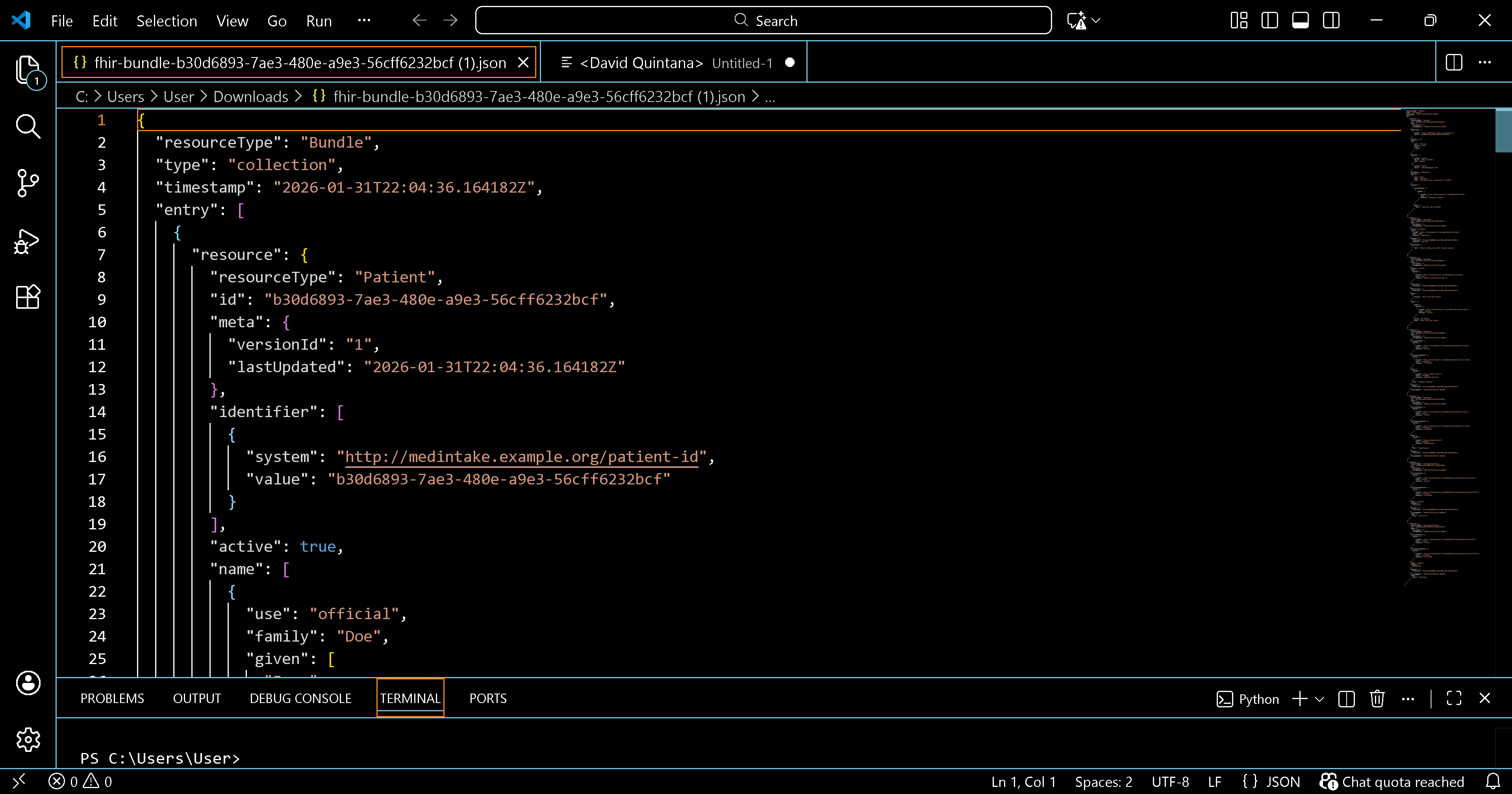 FHIR Bundle JSON opened in Visual Studio Code showing structured Patient resource data
